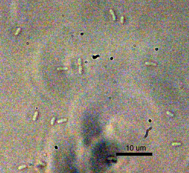 E. coli at 100X Magnification