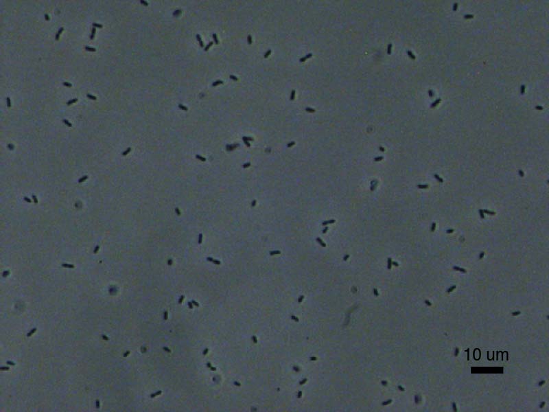 E. coli at 40x Magnification